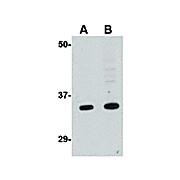 GRTP1 Antibody nterm 100µg