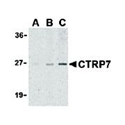 CTRP7 Antibody nterm 100µg
