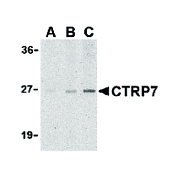 CTRP7 Antibody nterm 100µg