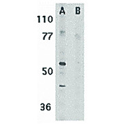 Anti-RIP3 (RABBIT) Antibody, 100µg, Liquid (sterile filtered)