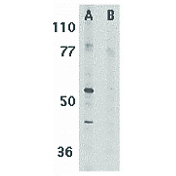 Anti-RIP3 (RABBIT) Antibody, 100µg, Liquid (sterile filtered)