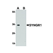Anti-SYNGR1 (RABBIT) Antibody, 100µg, Liquid (sterile filtered)