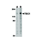 TSC1 Antibody cterm 100µg