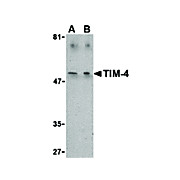 TIM-4 Antibody cterm 100µg