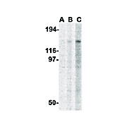 Anti-TBC1D1 (RABBIT) Antibody, 100µg, Liquid (sterile filtered)