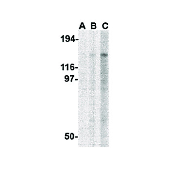 Anti-TBC1D1 (RABBIT) Antibody, 100µg, Liquid (sterile filtered)