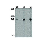 Rb Anti-STIM2 Antibody internal 100µg