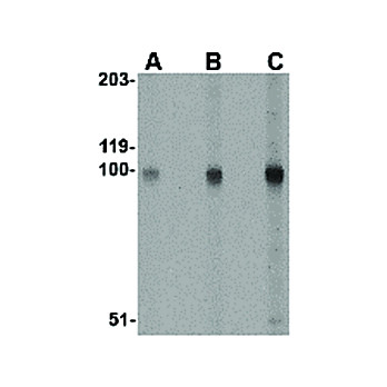 Rb Anti-STIM2 Antibody internal 100µg