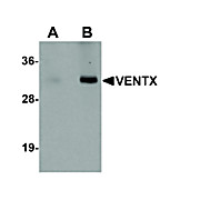 Anti-VENTX (RABBIT) Antibody, 100µg, Liquid (sterile filtered)