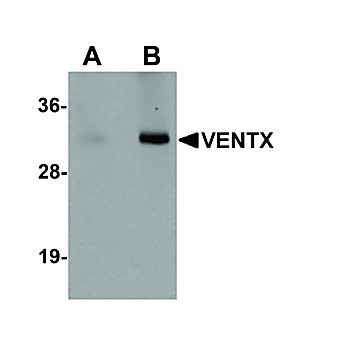 Anti-VENTX (RABBIT) Antibody, 100µg, Liquid (sterile filtered)