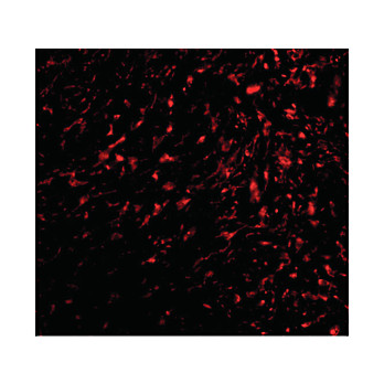 TEM5 Antibody internal 100µg