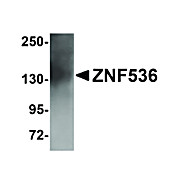 ZNF536 Antibody 100µg