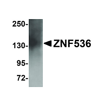 ZNF536 Antibody 100µg