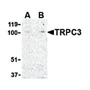 TRPC3 Antibody nterm 100µg