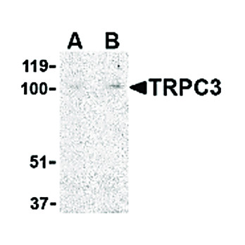 TRPC3 Antibody nterm 100µg