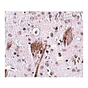 Anti-SPG11 (RABBIT) Antibody, 100µg, Liquid (sterile filtered)