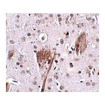 Anti-SPG11 (RABBIT) Antibody, 100µg, Liquid (sterile filtered)