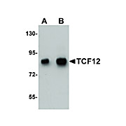 Anti-TCF12 (RABBIT) Antibody, 100µg, Liquid (sterile filtered)