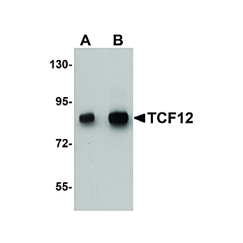 Anti-TCF12 (RABBIT) Antibody, 100µg, Liquid (sterile filtered)