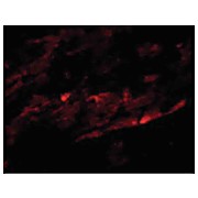 Anti-SPG15 (RABBIT) Antibody, 100µg, Liquid (sterile filtered)