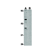 TRIM25 Antibody cterm 100µg