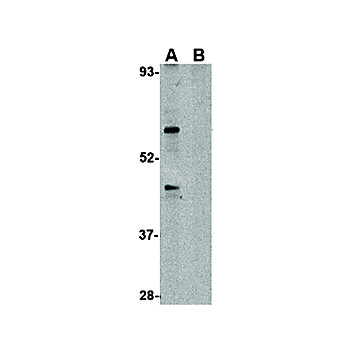 TRIM25 Antibody cterm 100µg