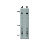 TEM5 Antibody cterm 100µg