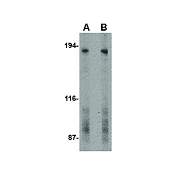 TEM5 Antibody cterm 100µg
