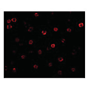 Anti-T-cadherin (RABBIT) Antibody, 100µg, Liquid (sterile filtered)