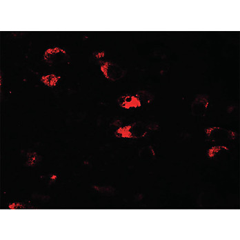 Anti-USP25 (RABBIT) Antibody, 100µg, Liquid (sterile filtered)