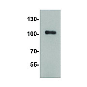 TRIM28 Antibody 100µg