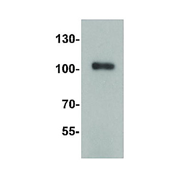 TRIM28 Antibody 100µg