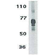 TCCR Antibody cterm 100µg