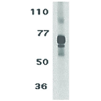 TCCR Antibody cterm 100µg