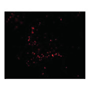 TRIM30 Antibody cterm 100µg