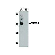 Anti-TWA1 (RABBIT) Antibody, 100µg, Liquid (sterile filtered)