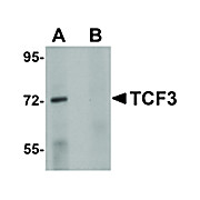 Anti-TCF3 (RABBIT) Antibody, 100µg, Liquid (sterile filtered)