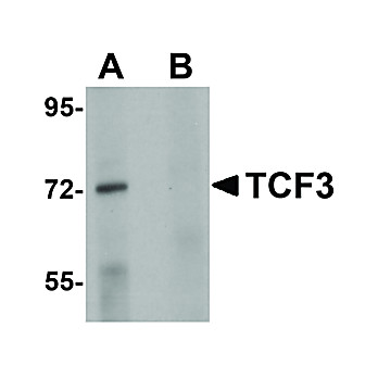 Anti-TCF3 (RABBIT) Antibody, 100µg, Liquid (sterile filtered)