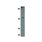 TOM70 Antibody nterm 100µg