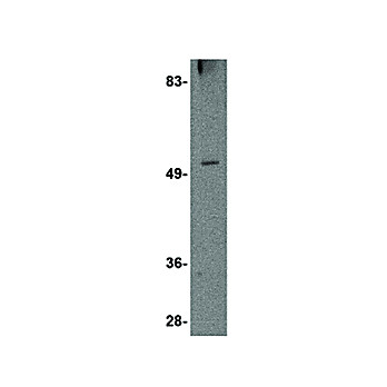TOM70 Antibody nterm 100µg
