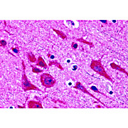Anti-TAB2 (RABBIT) Antibody, 100µg, Liquid (sterile filtered)