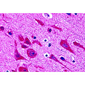 Anti-TAB2 (RABBIT) Antibody, 100µg, Liquid (sterile filtered)