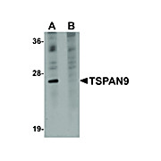 Anti-TSPAN9 (RABBIT) Antibody, 100µg, Liquid (sterile filtered)
