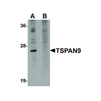 Anti-TSPAN9 (RABBIT) Antibody, 100µg, Liquid (sterile filtered)