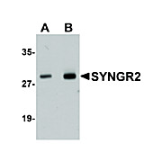 Anti-SYNGR2 (RABBIT) Antibody, 100µg, Liquid (sterile filtered)
