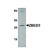 ZBED3 Antibody nterm 100µg