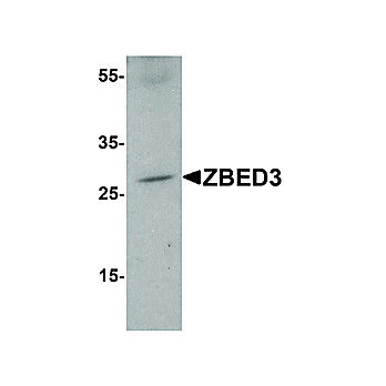 ZBED3 Antibody nterm 100µg