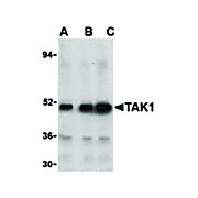 Anti-TAK1 (RABBIT) Antibody, 100µg, Liquid (sterile filtered)