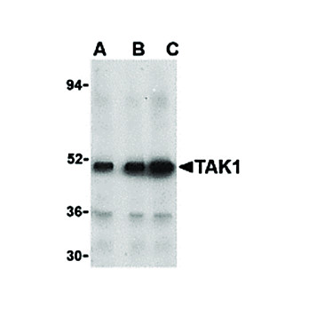 Anti-TAK1 (RABBIT) Antibody, 100µg, Liquid (sterile filtered)
