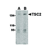 TSC2 Antibody nterm 100µg